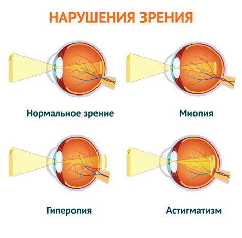 Мануальная терапия и нарушения зрения: решение проблемы с помощью массажа