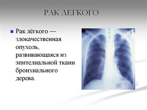 Меры предосторожности при проведении флюорографии у женщин