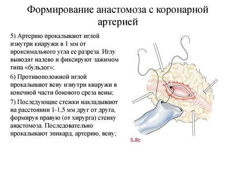 Методы лечения гонококков ABS