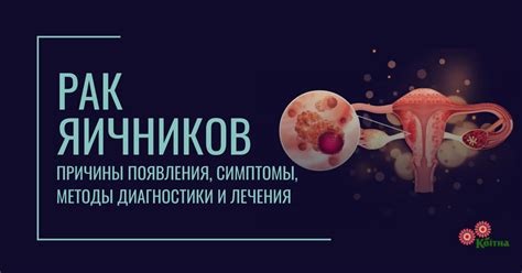 Методы лечения миомы яичников