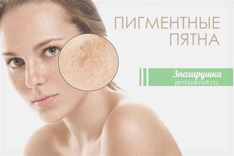 Методы профилактики коричневых пятен