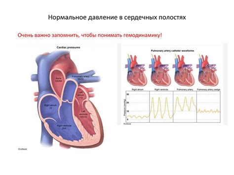 Механизмы увеличения массы миокарда левого желудочка