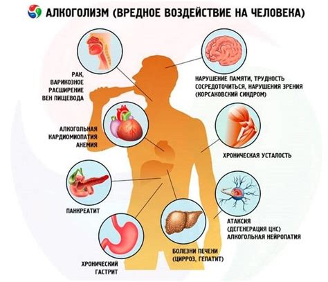 Механизм формирования снов при наличии алкоголя в организме: анализ процессов и влияние состояния опьянения