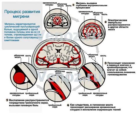 Мигрень головы у мужчин