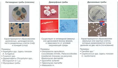 Микозы и грибковые инфекции