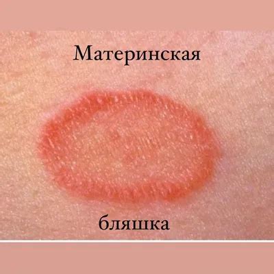 Мифы и предрассудки о высыпаниях на коже и их интерпретация