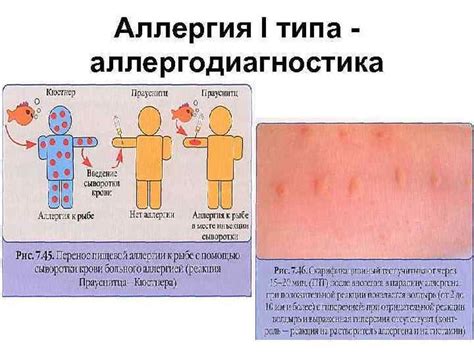 Многообразие факторов, способствующих возникновению аллергических проявлений у детей