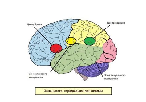 Моторная алалия: причины и симптомы