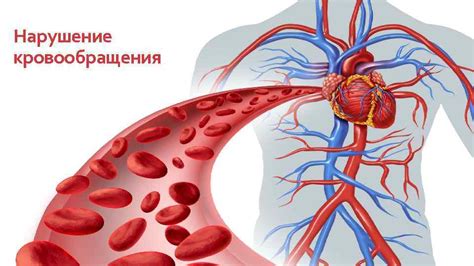 Нарушение кровообращения в области луковицы