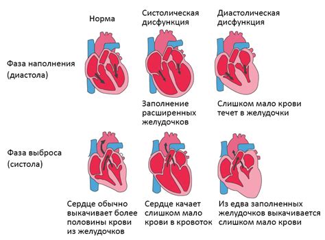 Нарушение сердечной функции