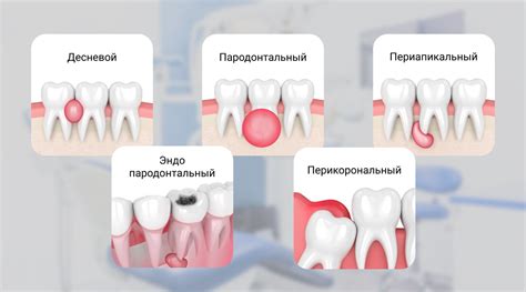 Нарыв на хвосте: как выглядит и как определить?