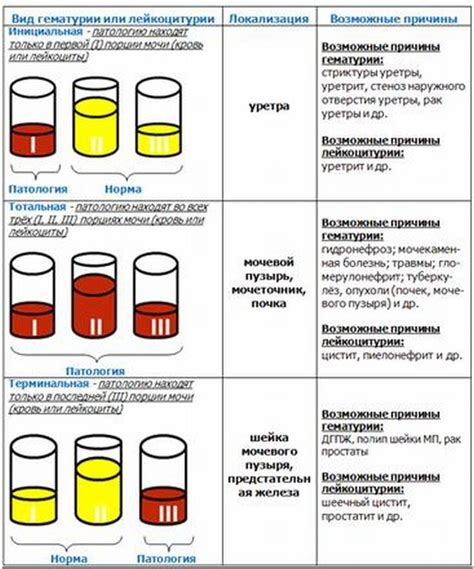 Нахождение крови в моче