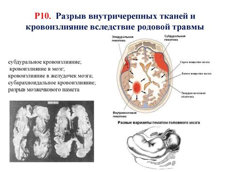 Нормоперфузия мозговой паренхимы у новорожденного