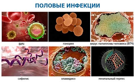 Обследование на ИППП у женщин: зачем?