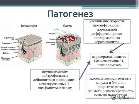 Опасности и особенности порождения эпидермальных проблеHead>