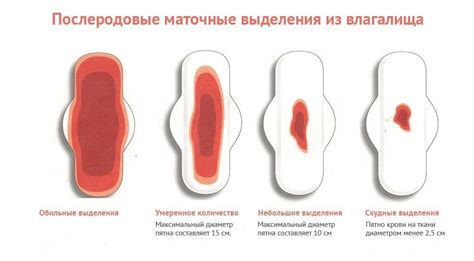 Опасности при обильных месячных: зачем мы должны обратить внимание на эту проблему?