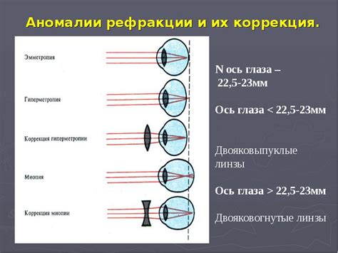 Определение нарушения рефракции глаза