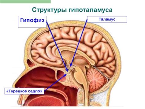 Осложнения пустого турецкого седла