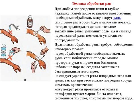 Основные методы обработки гнойной раны на пальце руки