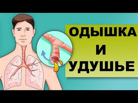 Основные причины одышки после пневмонии