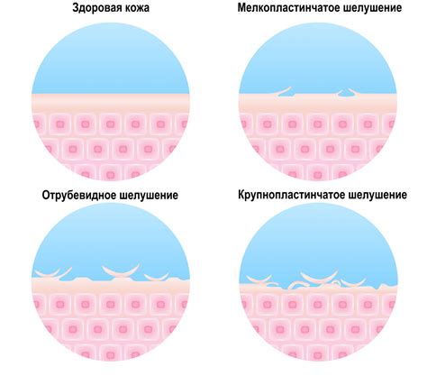 Основные факторы, вызывающие шелушение кожи