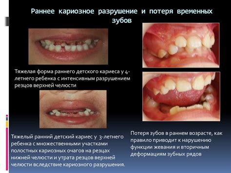 Основные факторы, приводящие к потере зубов во время снов у представителей мужского пола