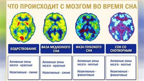 Особенности работы мозга во время сна