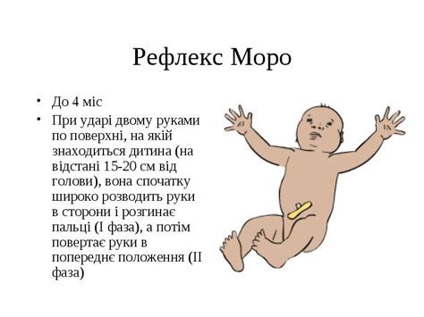 Отклонения и патологии рефлекса Моро