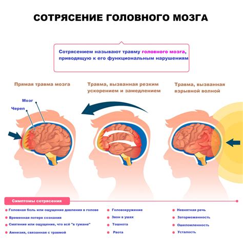 Отличия контузии головного мозга от сотрясения