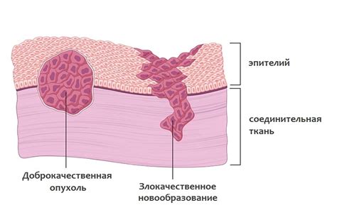 Отличия сходления опухоли на лице от сходления опухоли на других частях тела