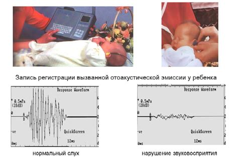 Отоакустическая эмиссия: природа исследования