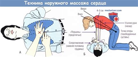 Отпечатки сердца и пульсометры для обеспечения первой помощи при сердечных проблемах