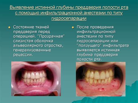 Паразиты в полости рта