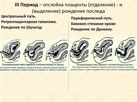 Патологические состояния, препятствующие отделению плаценты