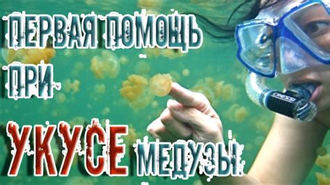 Первая помощь при укусе медузы