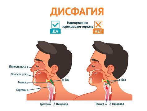 Пищевой спазм и дисфагия