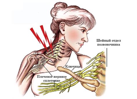 Плечевая боль: возможные причины и способы избавления