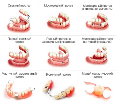 Положительные и отрицательные стороны снов с полировкой зубов