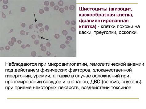 Понятие ретикулоцитов высокой флюоресценции