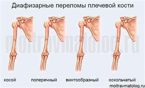 Последствия падения и состояние плеча