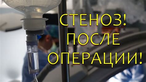 Послеоперационный период: что следует ожидать и как восстановиться после операции на коленном суставе