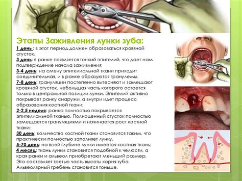 Потенциальные ситуации, приводящие к символическому образу удаления зуба без присутствия крови и неприятных ощущений