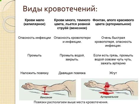 Потеря крови из-за травмы или операции