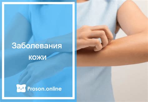 Почему возникает чесотка ног перед сном?