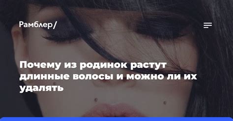 Почему волосы растут из родинок?