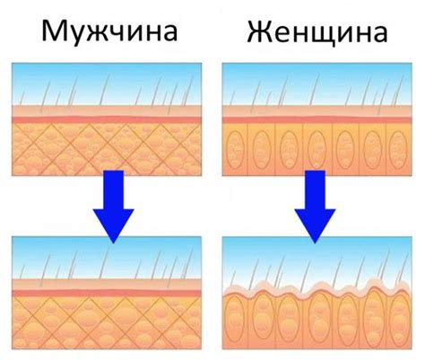 Почему мужчины не имеют целлюлита?