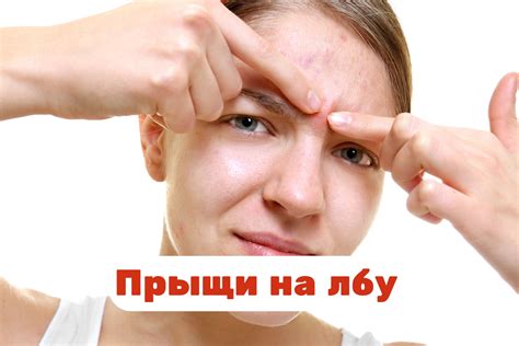 Почему на лбу возникают опухшие прыщи?