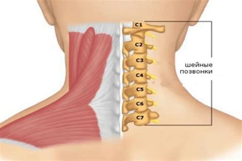 Почему происходит выпирание позвонка на шее?