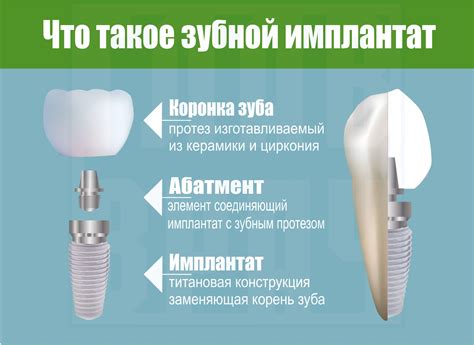 Почему стоит проводить терапию зубов и какие преимущества это предоставляет?