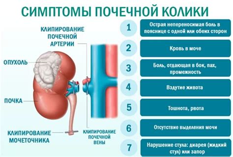 Почечная колика: симптомы, причины и способы облегчения